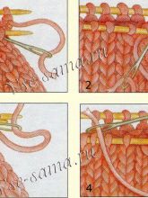Шов Китченера