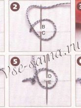 Узелковый шов